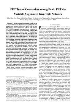 PET Tracer Conversion among Brain PET via Variable Augmented Invertible
  Network