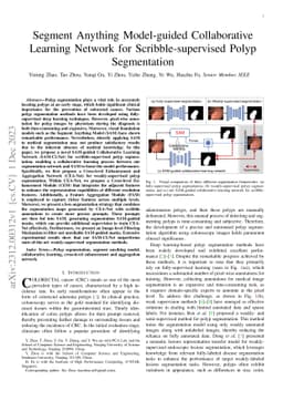 Segment Anything Model-guided Collaborative Learning Network for
  Scribble-supervised Polyp Segmentation