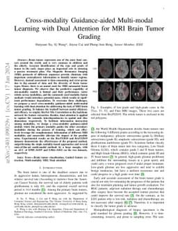 Cross-modality Guidance-aided Multi-modal Learning with Dual Attention
  for MRI Brain Tumor Grading