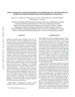 FDNet: Frequency Domain Denoising Network For Cell Segmentation in
  Astrocytes Derived From Induced Pluripotent Stem Cells
