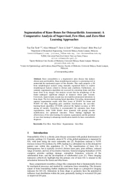 Segmentation of Knee Bones for Osteoarthritis Assessment: A Comparative
  Analysis of Supervised, Few-Shot, and Zero-Shot Learning Approaches