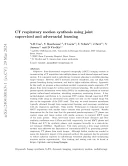 CT respiratory motion synthesis using joint supervised and adversarial
  learning