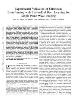 Experimental Validation of Ultrasound Beamforming with End-to-End Deep
  Learning for Single Plane Wave Imaging