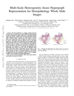 Multi-Scale Heterogeneity-Aware Hypergraph Representation for
  Histopathology Whole Slide Images