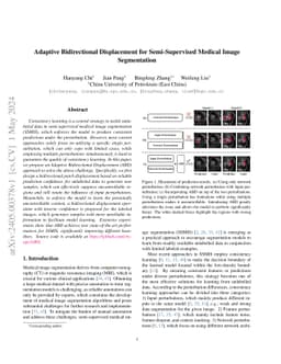 Adaptive Bidirectional Displacement for Semi-Supervised Medical Image
  Segmentation