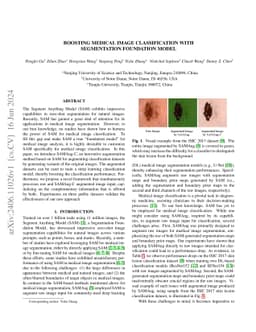 Boosting Medical Image Classification with Segmentation Foundation Model