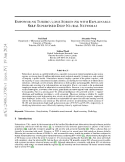 Empowering Tuberculosis Screening with Explainable Self-Supervised Deep
  Neural Networks