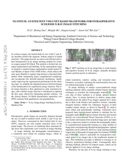 SX-Stitch: An Efficient VMS-UNet Based Framework for Intraoperative
  Scoliosis X-Ray Image Stitching