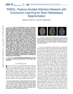 FANCL: Feature-Guided Attention Network with Curriculum Learning for
  Brain Metastases Segmentation
