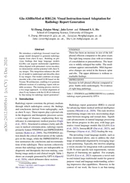 Gla-AI4BioMed at RRG24: Visual Instruction-tuned Adaptation for
  Radiology Report Generation