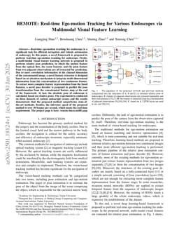 REMOTE: Real-time Ego-motion Tracking for Various Endoscopes via Multimodal Visual Feature Learning