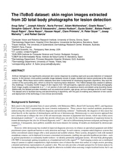 The iToBoS dataset: skin region images extracted from 3D total body photographs for lesion detection