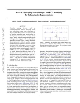 CuPID: Leveraging Masked Single-Lead ECG Modelling for Enhancing the Representations