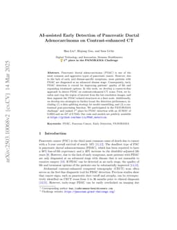 AI-assisted Early Detection of Pancreatic Ductal Adenocarcinoma on Contrast-enhanced CT