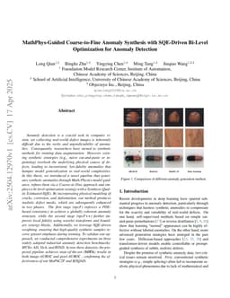 MathPhys-Guided Coarse-to-Fine Anomaly Synthesis with SQE-Driven Bi-Level Optimization for Anomaly Detection