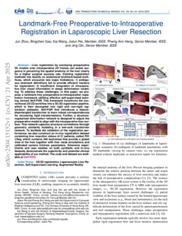 Landmark-Free Preoperative-to-Intraoperative Registration in Laparoscopic Liver Resection