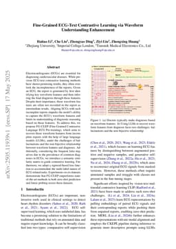 Fine-Grained ECG-Text Contrastive Learning via Waveform Understanding Enhancement