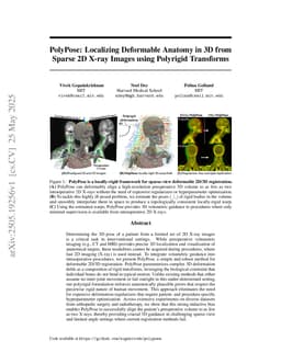PolyPose: Localizing Deformable Anatomy in 3D from Sparse 2D X-ray Images using Polyrigid Transforms