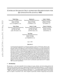 Contrast-Invariant Self-supervised Segmentation for Quantitative Placental MRI