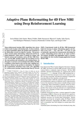 Adaptive Plane Reformatting for 4D Flow MRI using Deep Reinforcement Learning