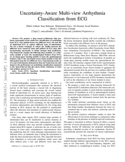 Uncertainty-Aware Multi-view Arrhythmia Classification from ECG