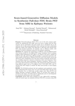 Score-based Generative Diffusion Models to Synthesize Full-dose FDG Brain PET from MRI in Epilepsy Patients