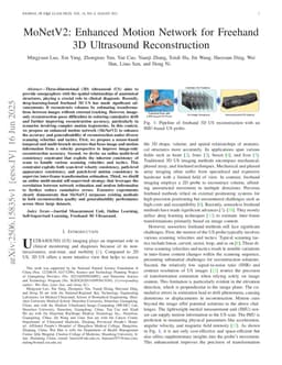 MoNetV2: Enhanced Motion Network for Freehand 3D Ultrasound Reconstruction